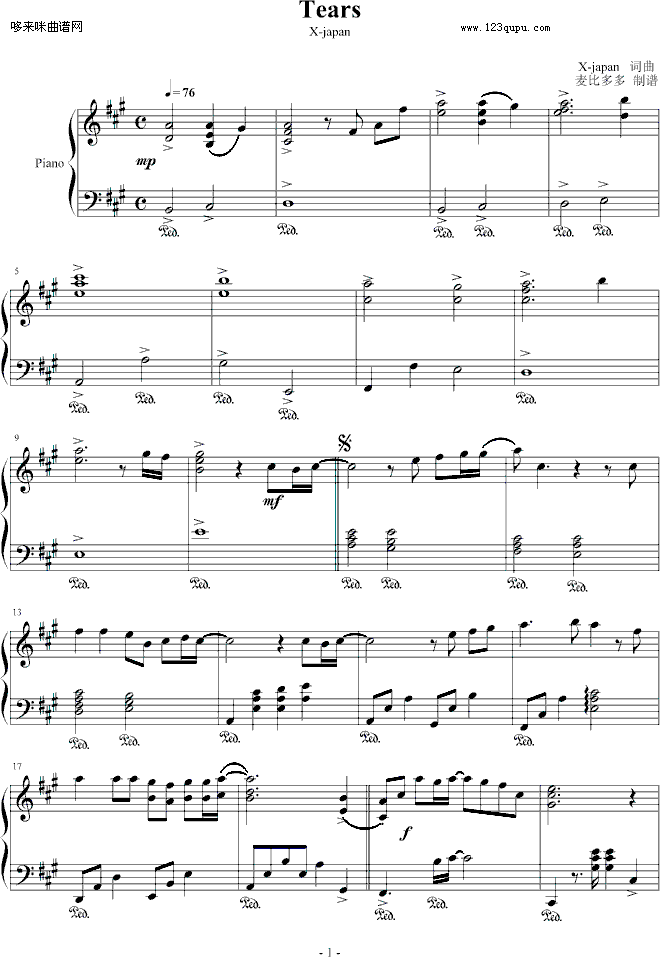 Tears-���ȶ��-X-JAPAN(����V)1